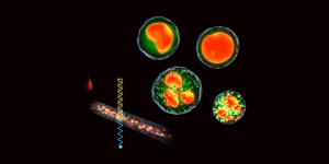 Pictured is a blood sample treated with a new dye assay developed by researchers at CalTech and LeukoDx. The sample flows through a microfluidic channel (lower left), providing fluorescence that enables a laser to count each of the four major subtypes of white blood cells (upper right) in blood. (Photo copyright Wendian Shi of Caltech.)