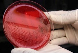 An agar plate with listeria cultures ready for testing in the Medical Microbiology lab at the Houston Health and Human Services Department on Thursday, June 18, 2015, in Houston. (Photo and caption copyright: Mayra Beltran/Houston Chronicle.)