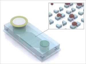 With the “liquid biopsy” device (pictured here) developed by researchers at Harvard University, ascites fluid from ovarian cancer patients flows through a filter into an inlet (left) where magnetically labeled benign cells are trapped. The remaining fluid passes through a microchip containing microwells that capture (insert) antibody-labeled tumor cells for collection, imaging and additional analyses. (Illustration copyright Hakho Lee and Jaehoon Chung, Massachusetts General Hospital Center for Systems Biology.)