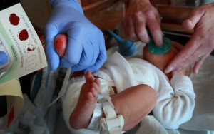 Pictured above is the collection of a specimen as part of state-mandated newborn screening (NBS) programs. News coverage by the Milwaukee Journal Sentinel revealed that delays and other problems with the NBS program have harmed some newborn babies. Clinical laboratories at hospitals across the nation should be taking steps to ensure that NBS samples are sent promptly to their state’s NBS lab facility. (Photo copyrights: Kristyna Wentz-Graff/Journal Sentinel.)