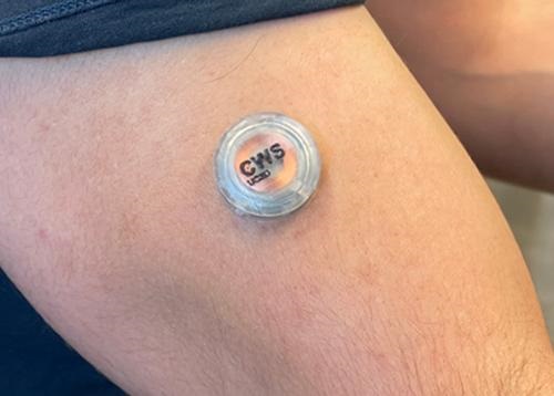 UC San Diego’s wearable microneedle patch